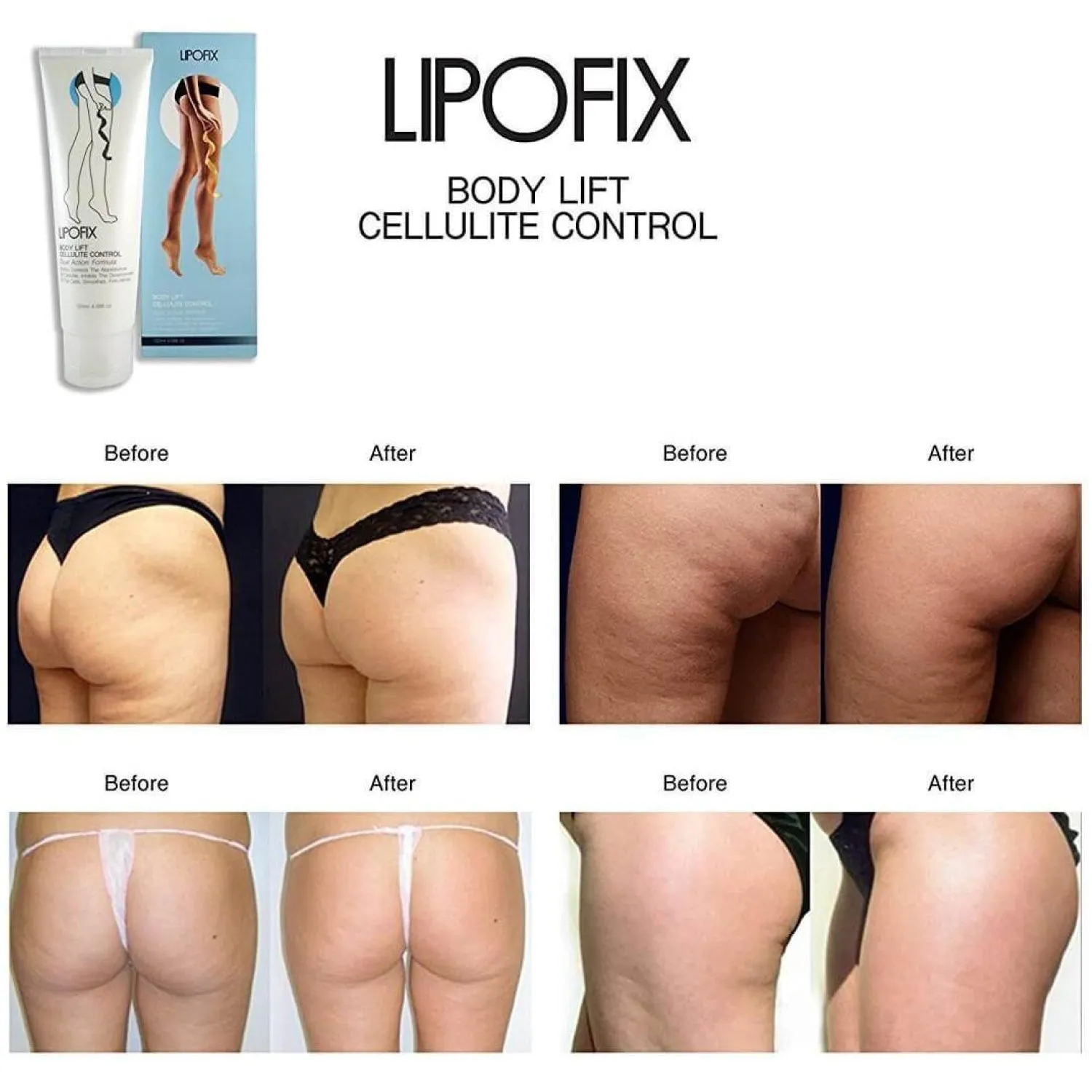 Anti Cellulite Contour Body Firming and Toning Cream LipoFix